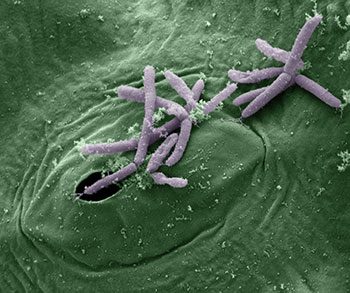 5 cose che non sai sui batteri