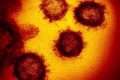 Documento del 2005 avverte: Prepararsi alla prossima pandemia di coronavirus -  Michael Osterholm – direttore del Centro per la ricerca e la gestione delle malattie infettive