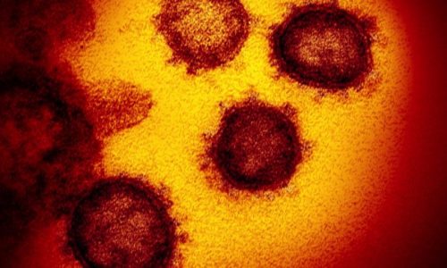 Documento del 2005 avverte: Prepararsi alla prossima pandemia di coronavirus –  Michael Osterholm – direttore del Centro per la ricerca e la gestione delle malattie infettive
