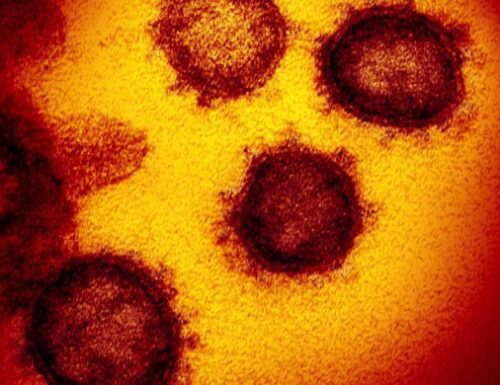 Documento del 2005 avverte: Prepararsi alla prossima pandemia di coronavirus –  Michael Osterholm – direttore del Centro per la ricerca e la gestione delle malattie infettive